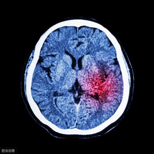 梦见半身不遂周公解梦,梦见半身不遂是什么意思?