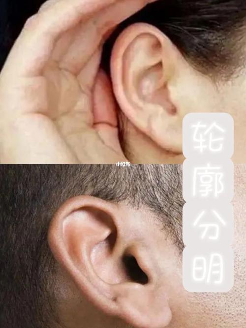 耳廓不分明的人待人处事非常软弱吗