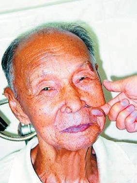 梦见鼻子里抽出长条状啥意思