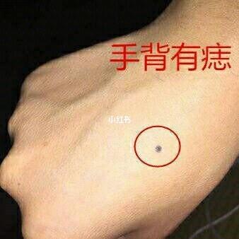 手上长痣的人有福吗