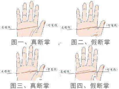 最详细断掌(通贯手)图解 接掌形断掌