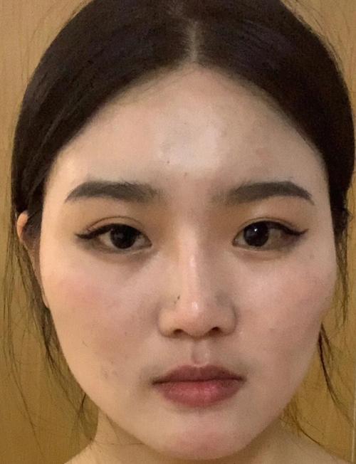 颧骨一高一低、一大一小或下坠好不好？