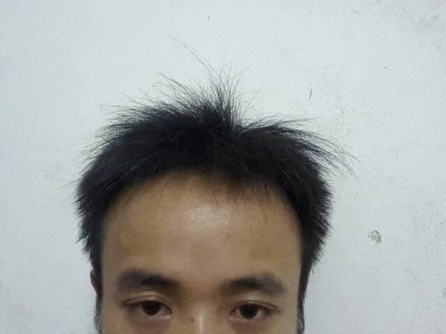 马眼的男人晚年孤独是为何