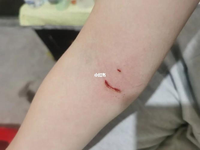 梦见打针流血,爱情面有乐事