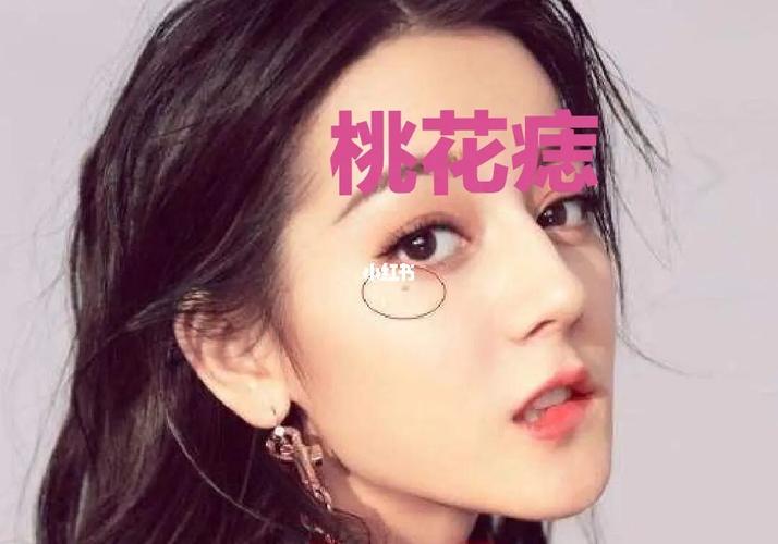 下巴长痣的人是不是桃花运很差
