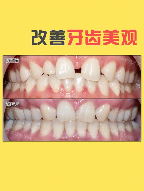 门牙牙缝大面相怎么说如何理解(详解)