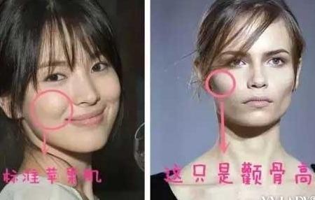笑起来颧骨高面相究竟好不好