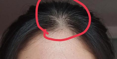 女人额头有旋不吉利