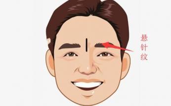 额头印堂有竖纹,难生儿
