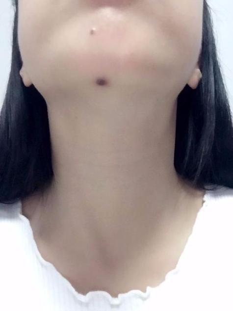下巴磕底部有痣的女人