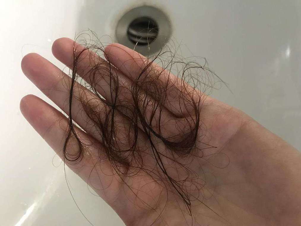 梦见掉了一大把头发是什么意思