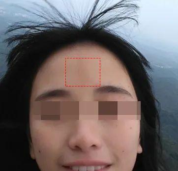 小孩印堂发黑会出现血光之灾吗