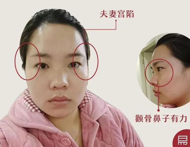 颧骨突出的面相怎么样