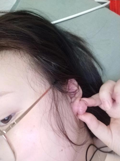 耳朵上有疤痕表示的意思!