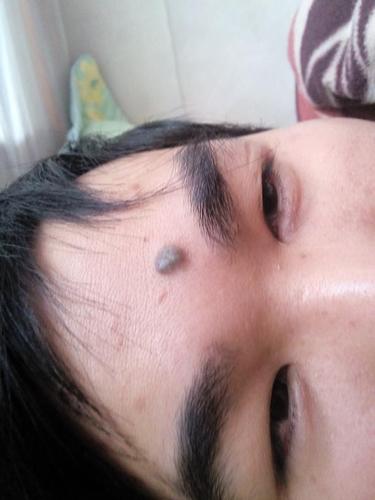 千金难买额头痣是真的吗
