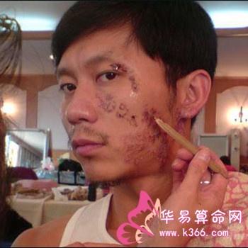 梦见脸上生疮