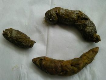 女人梦见很大一堆屎