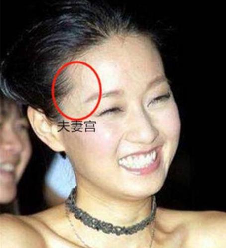 夫妻宫有疤痕注定婚姻不幸吗