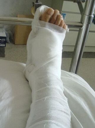 梦见床腿断了是什么意思