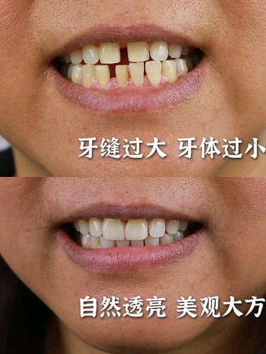 门牙有缝的女人好不好