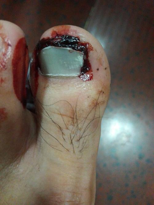 梦见斧子砸到脚