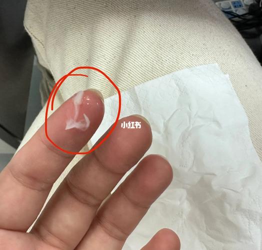 梦见硫酸怎么回事