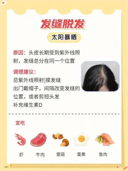 十二星座什么时候会秃头?天蝎为秃头代言