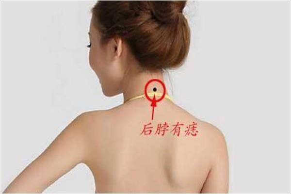 后脖子发根处有痣图解