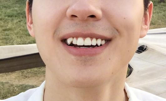 长虎牙的男人命运