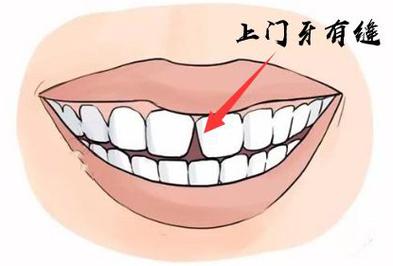 门牙有缝代表什么,有何面相说法