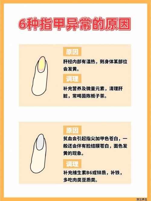 指甲看命运贵贱