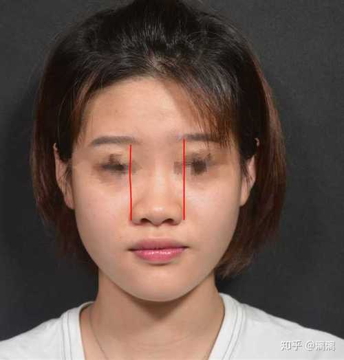 塌鼻子怎么办？