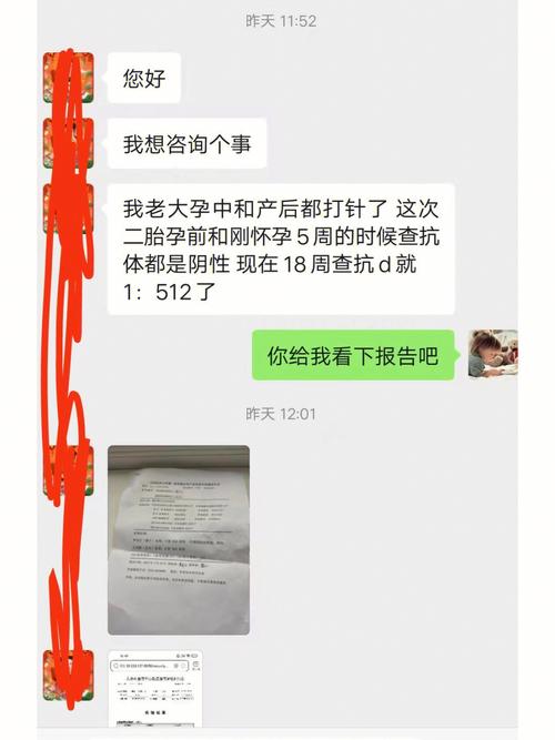 抗D效价检查一般多少钱