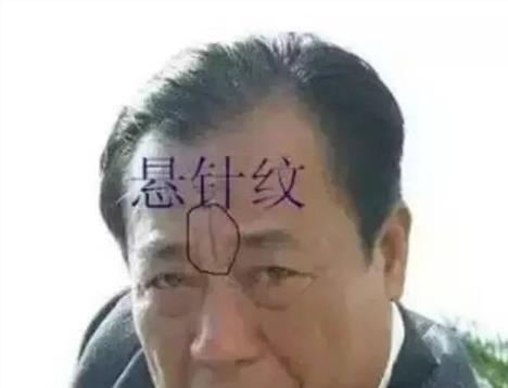 眉中间有一竖纹征兆