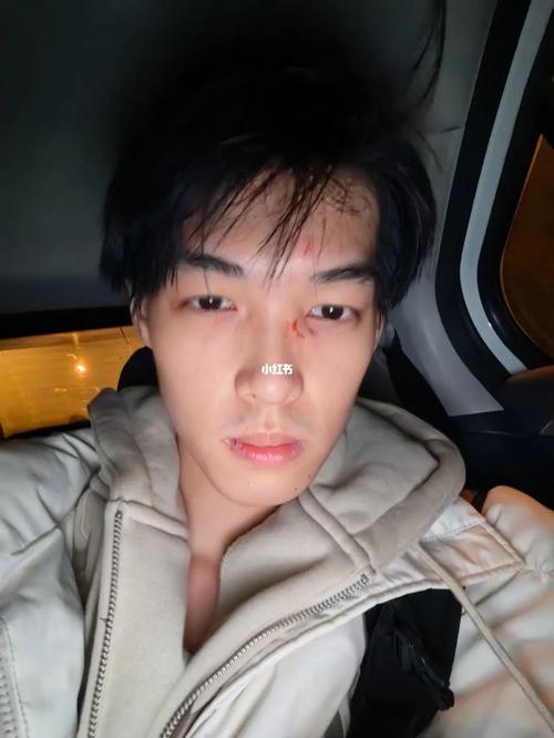 菱形脸的人破相会克夫吗