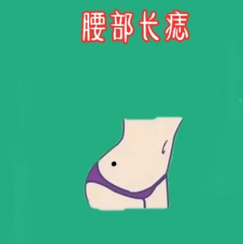 腰部长痣的女人命苦吗?