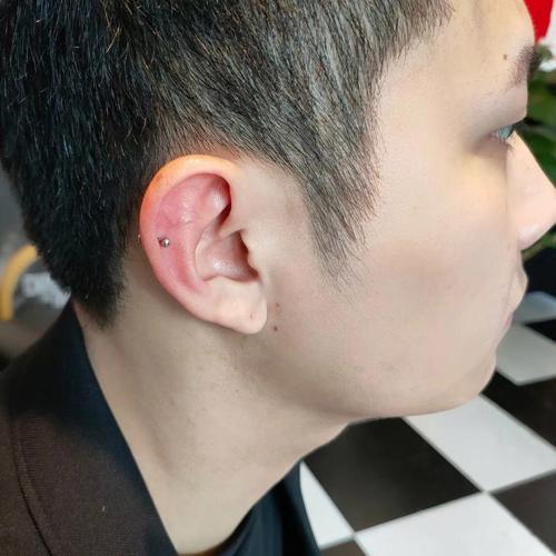 耳骨外翻的男人不能嫁