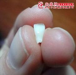 梦见下边的大牙掉