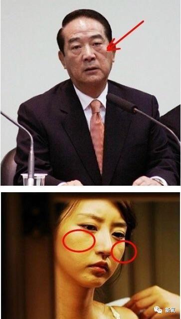 颧骨有破颧纹的女人克夫吗