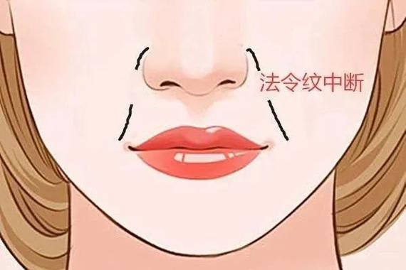法令纹过长运途不顺