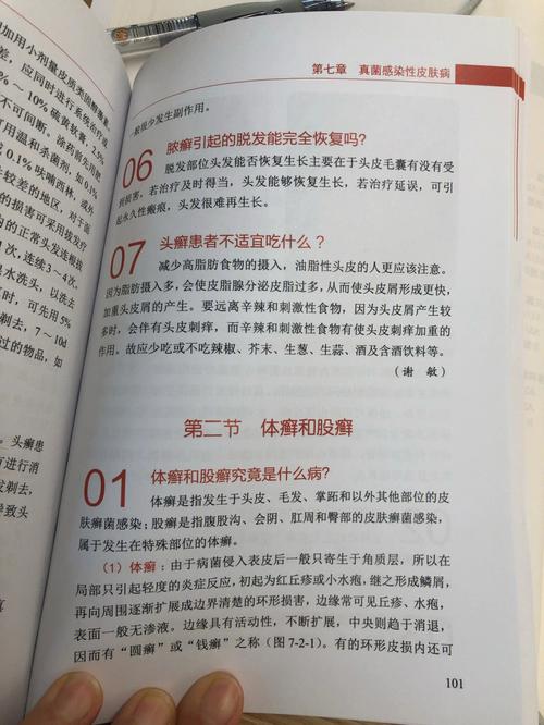 梦见头癣怎么回事