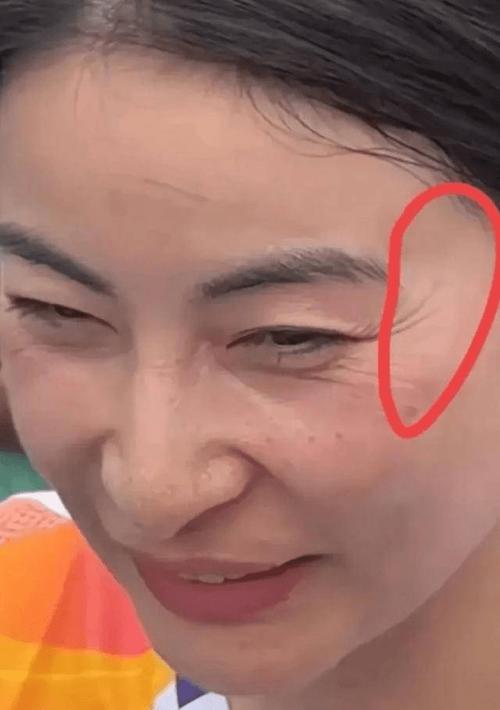 女人鱼尾纹的面相
