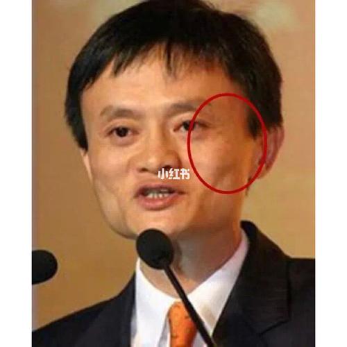 眼睛凸面相好吗