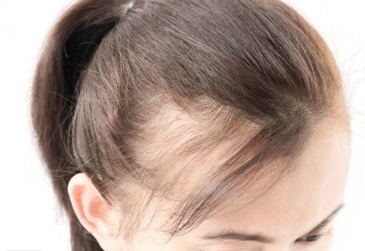 头发多的女人是不是命不好