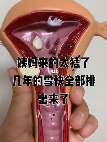 梦见来大姨妈了,梦到自己来例假了见血了是什么意思