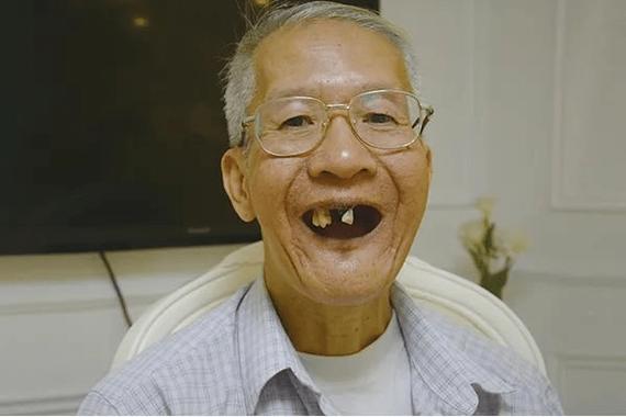 上牙掉了代表什么亲人