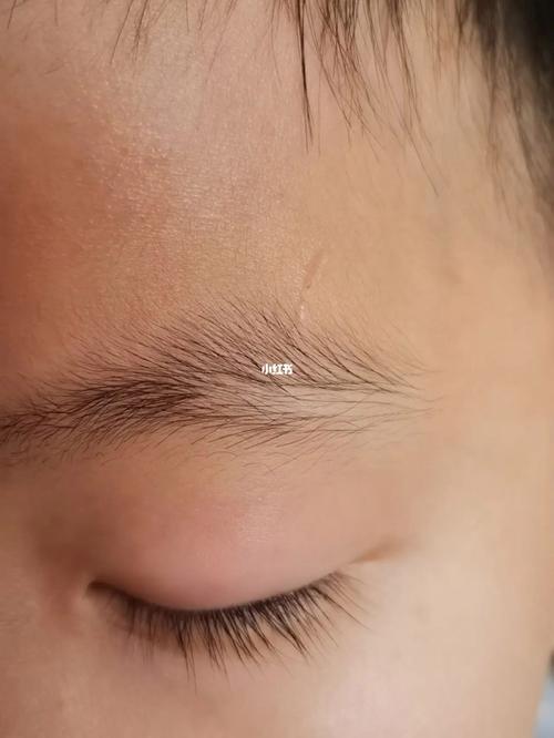 额头有疤痕是什么意思？