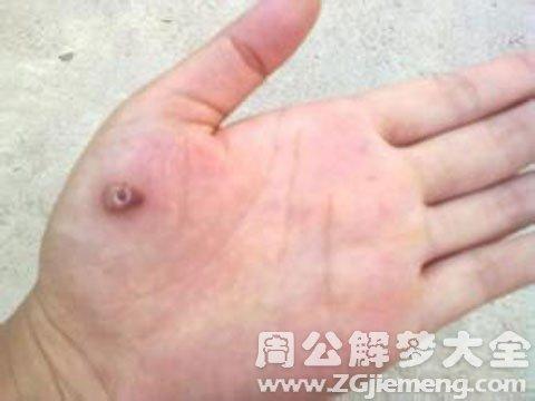 梦见长鸡眼