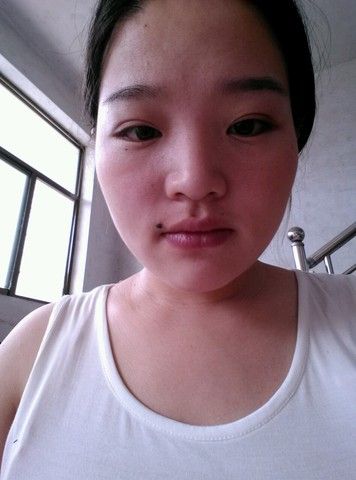 这些地方长痣绝对不能娶,容易带来绿帽