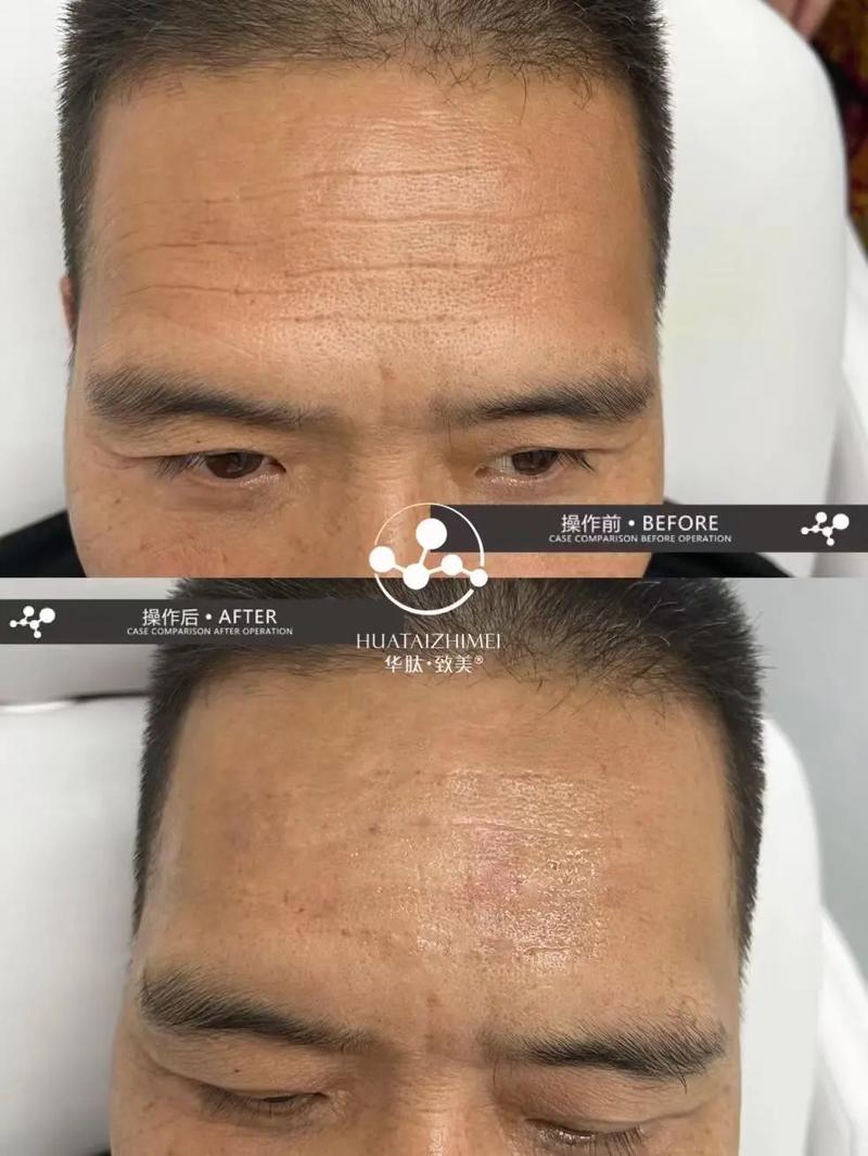 头发不能遮额头印堂会带来什么影响